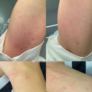 虎牙被抬员工一审宣判：虎牙败诉！被判公开道歉7天