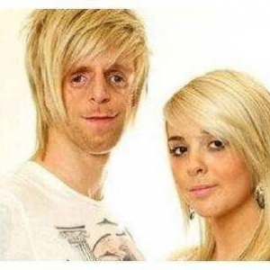 脸部畸形的男子迎娶美女大学生 孩子出生后夫妻傻眼