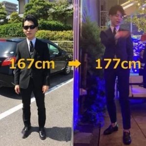 是个狠人！日本男子花费500万日元做增高手术 狂掉24斤